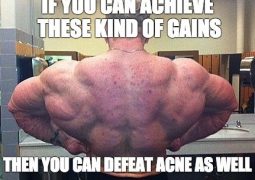 Does Acne Always Have to Accompany Gains?